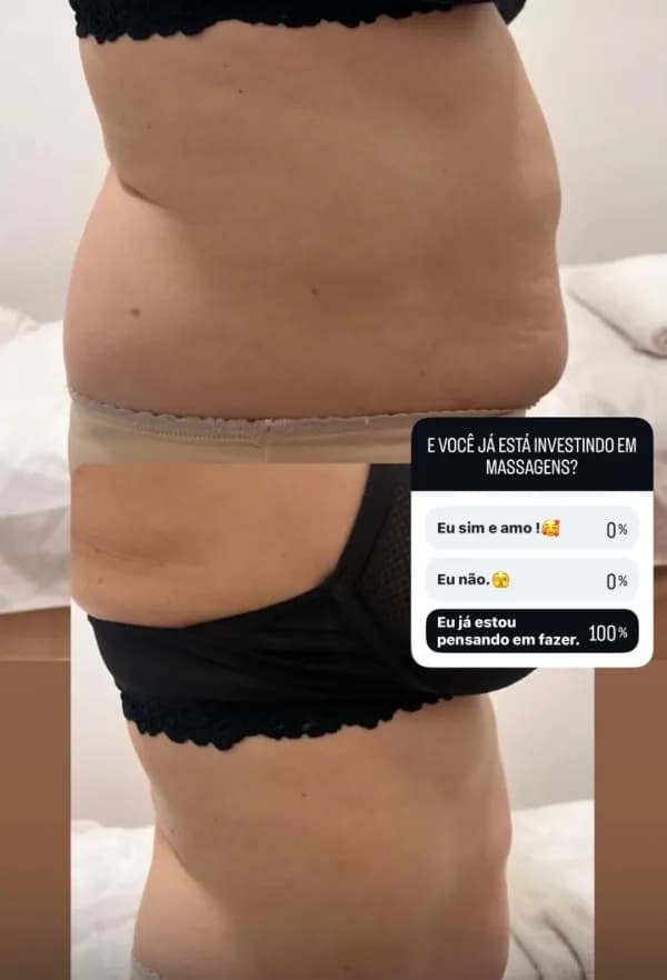 An abdomen from the side, before above and after below.