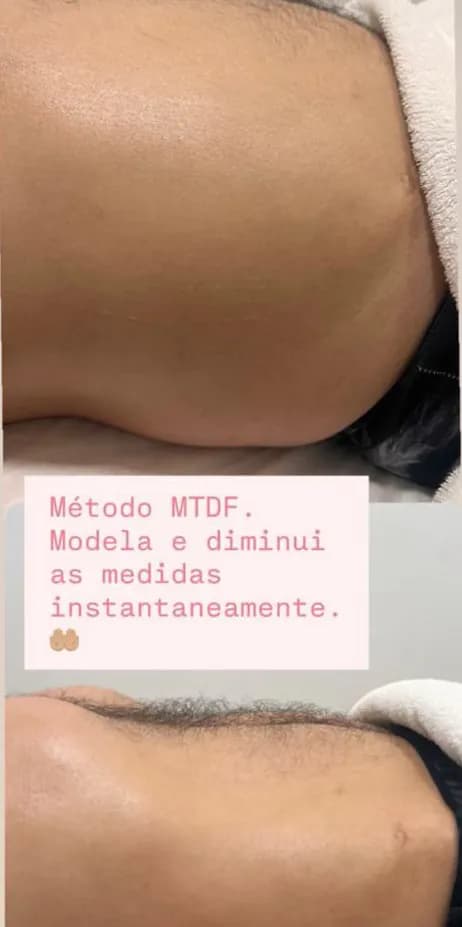 A close-up of the flank, before above and after below, captioned “The MTDF Method. It shapes and reduces measurements instantly.”
